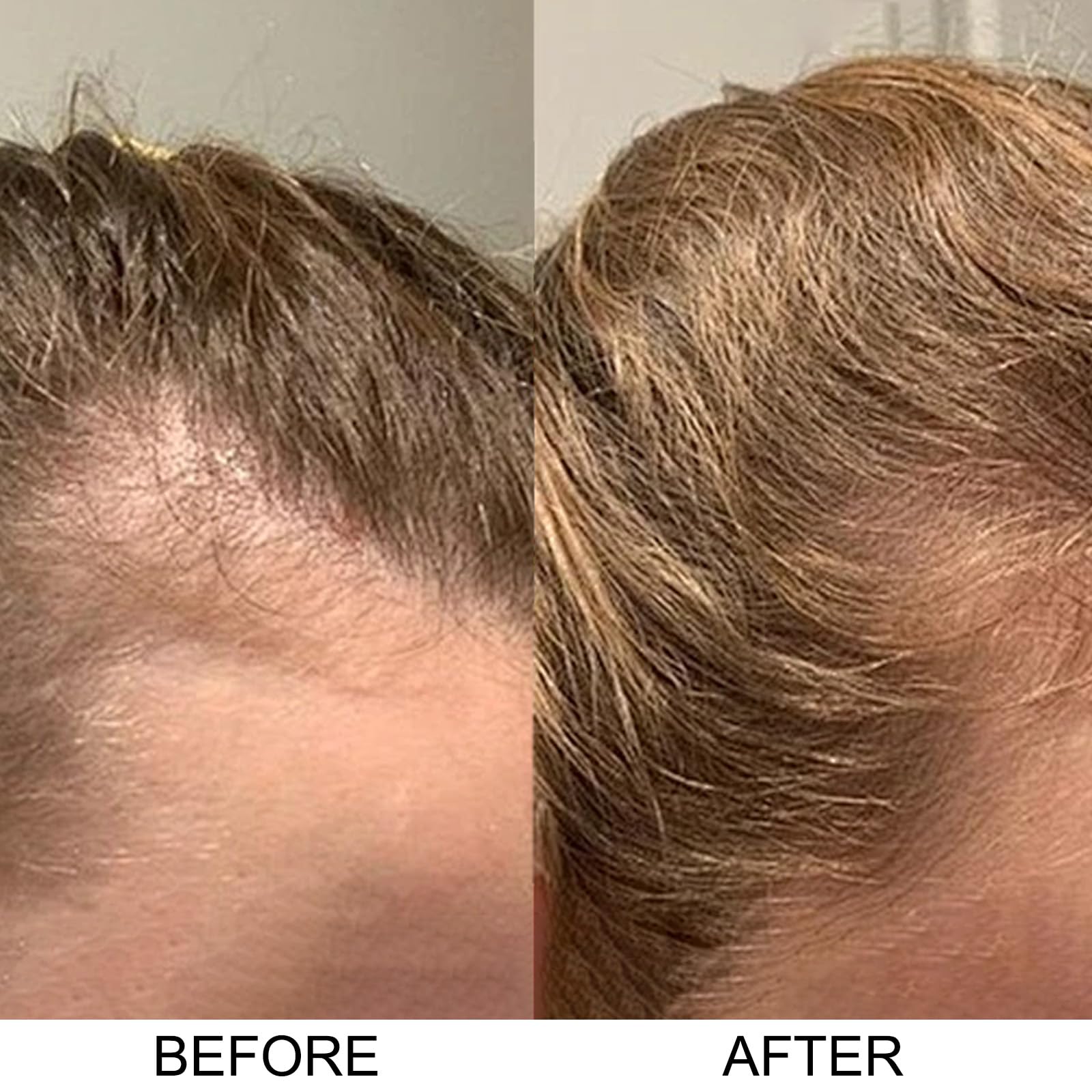 Excalvo Onion Shampoo lather demonstrates gentle cleansing for all hair types