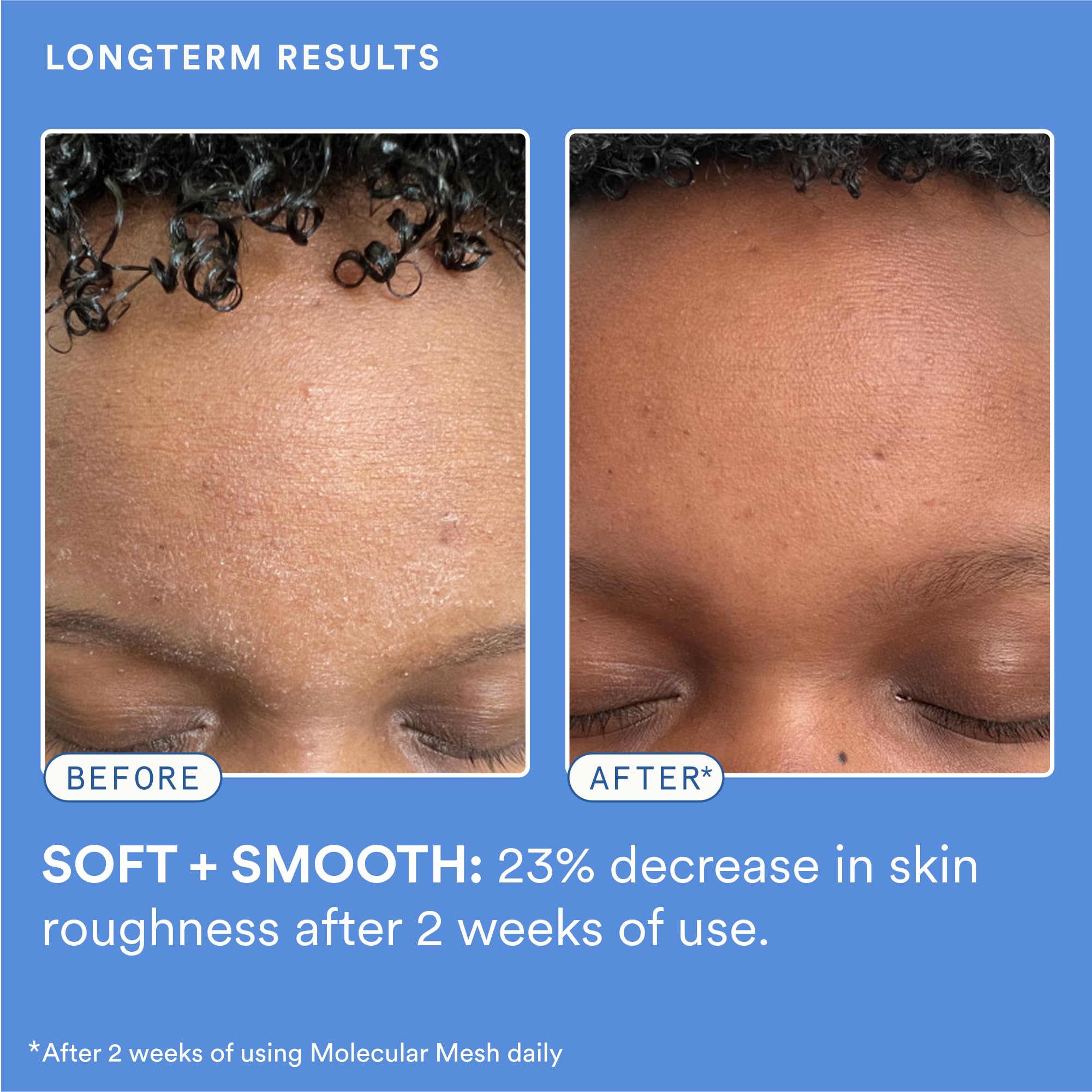 Experiment bio-stimulated repair centella ectoin on skin surface demonstrates renewal support.
