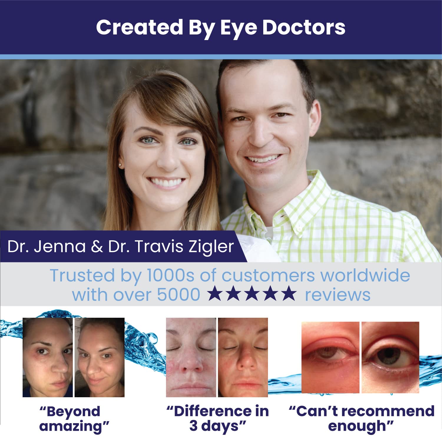 Eye Love Lid and Lash Cleanser 1oz bottle used on cotton pad for at-home eyelid care.