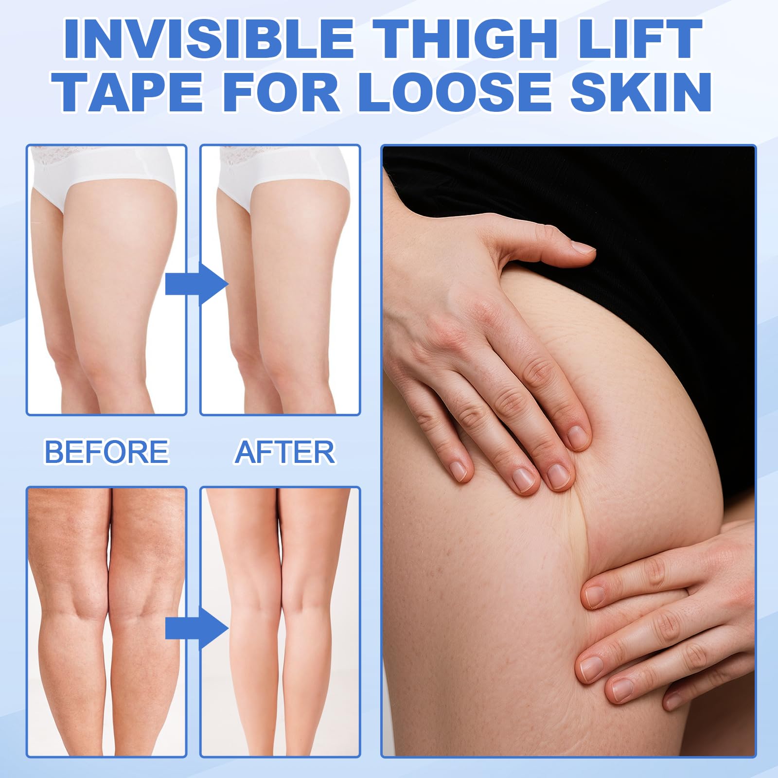 EYEKSTON multi-use tape supports arms, abdomen, and buttocks with reduced friction