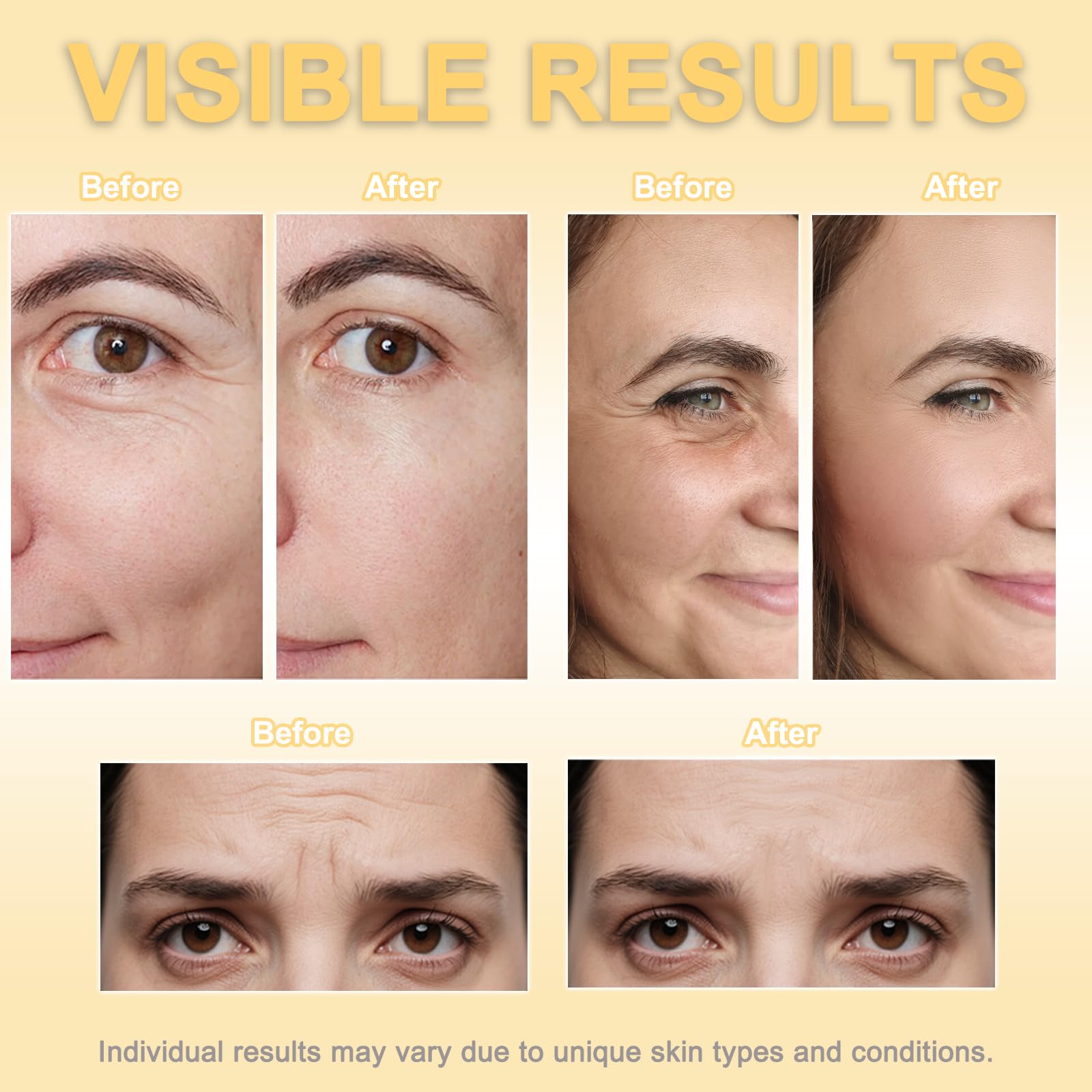 Face Tape overnight-application enables discreet wear while you sleep.