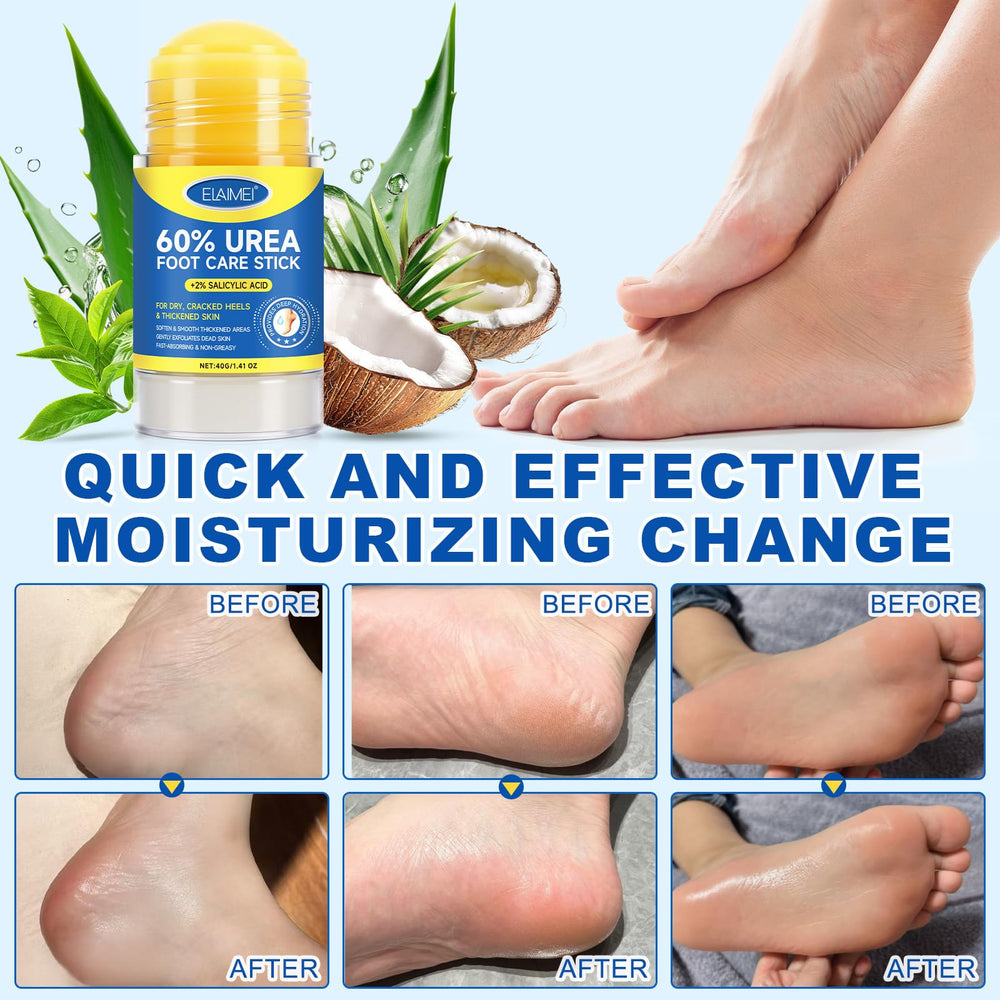 FANSHI Urea Stick with tea tree oil and allantoin for soothing care.