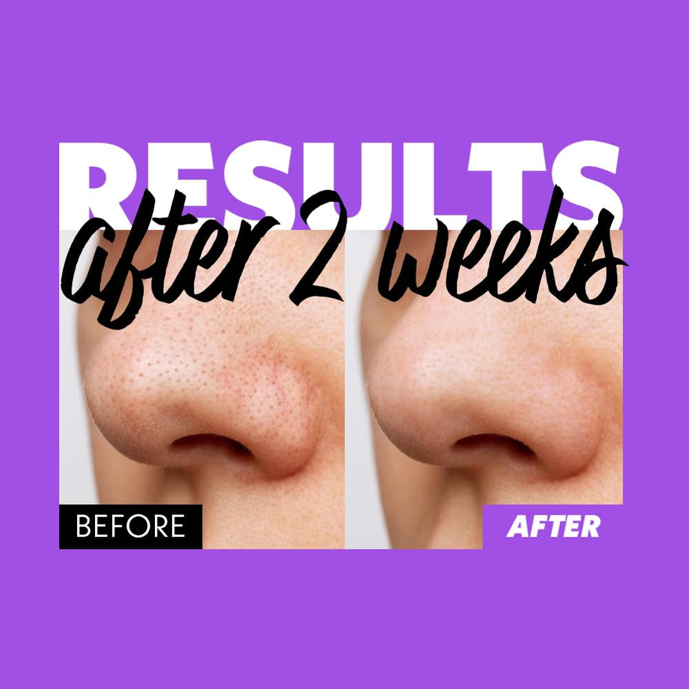 Fation Nosca9 daily cleansing routine for sensitive skin.