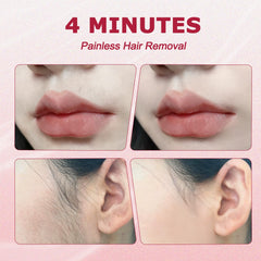 FCBSDAW upper lip area during treatment for painless fuzz removal