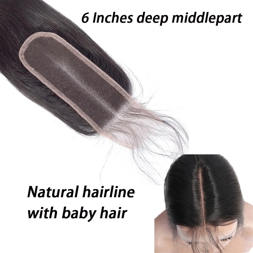 FEHOKA 2x6 closure with bleached knots for a cleaner scalp look