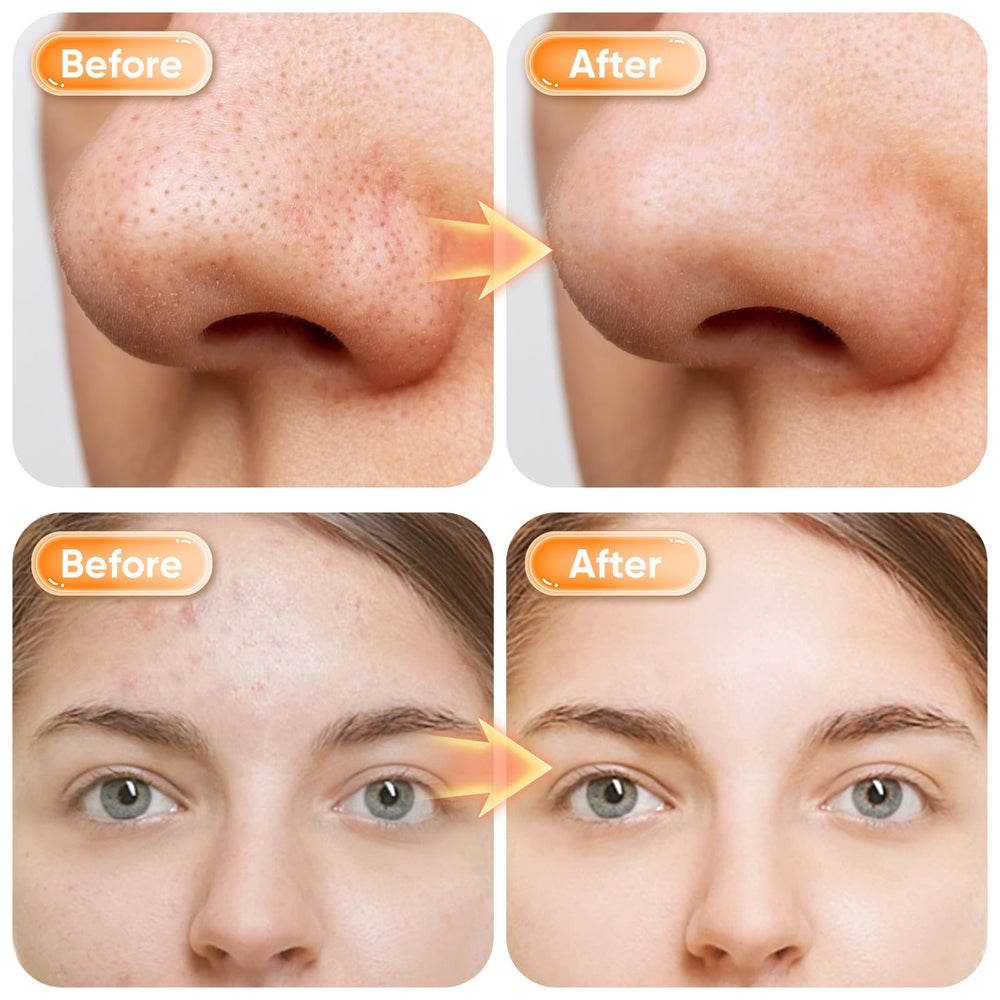 Gentle circular massage with the cleanser enhances cleansing and relaxation.