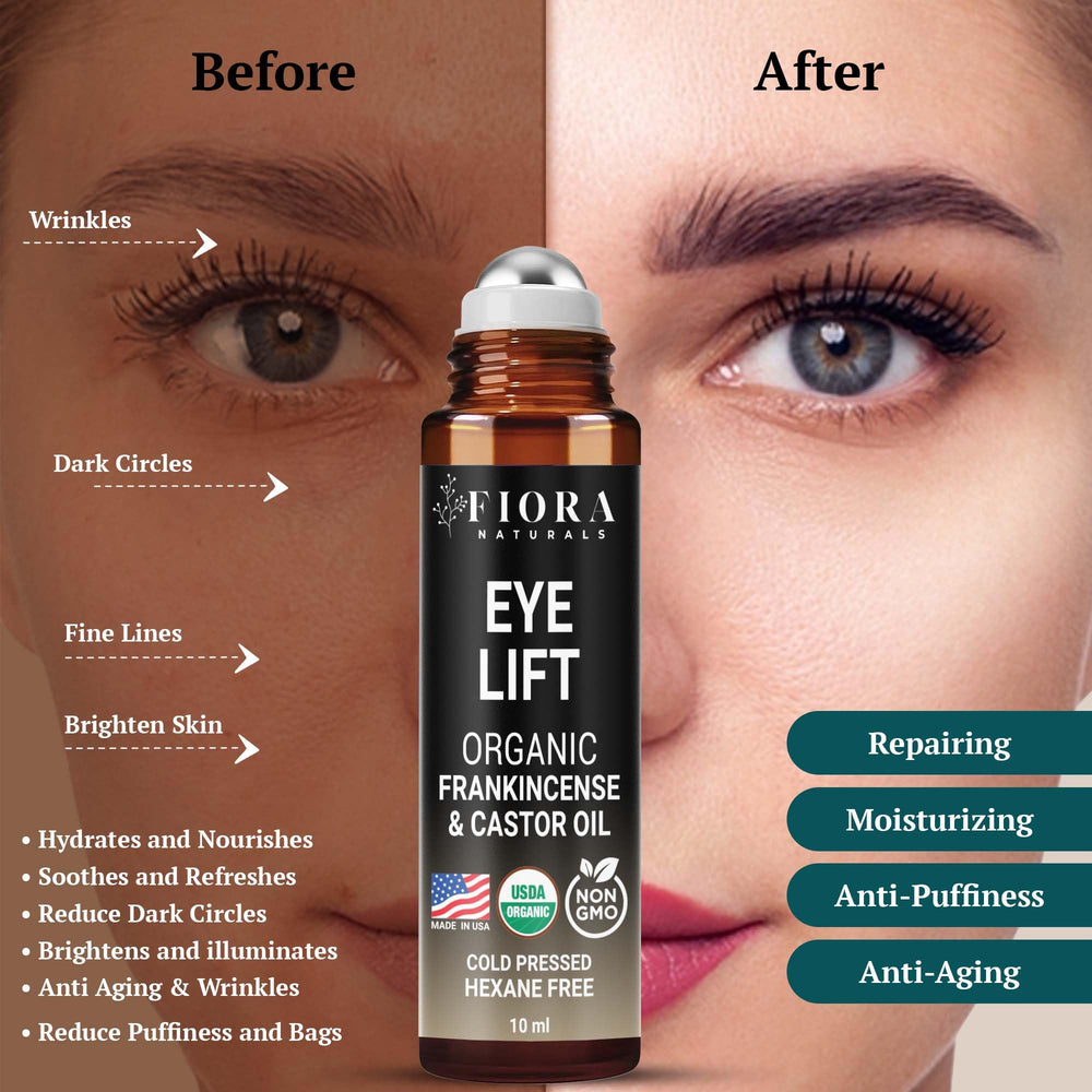 Fiora Naturals bottle cap helps prevent leaks during transit
