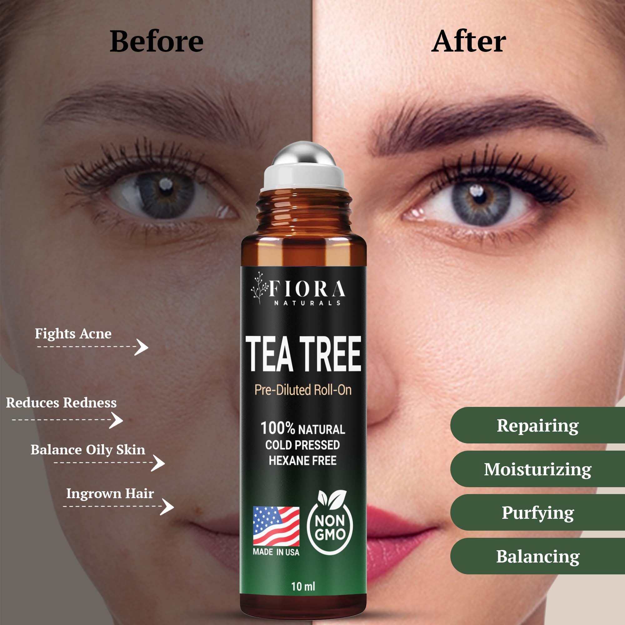 Fiora Naturals Tea Tree Oil Roll-On applied on a small blemish for appearance improvement.