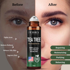 Fiora Naturals Tea Tree Oil Roll-On applied on a small blemish for appearance improvement.