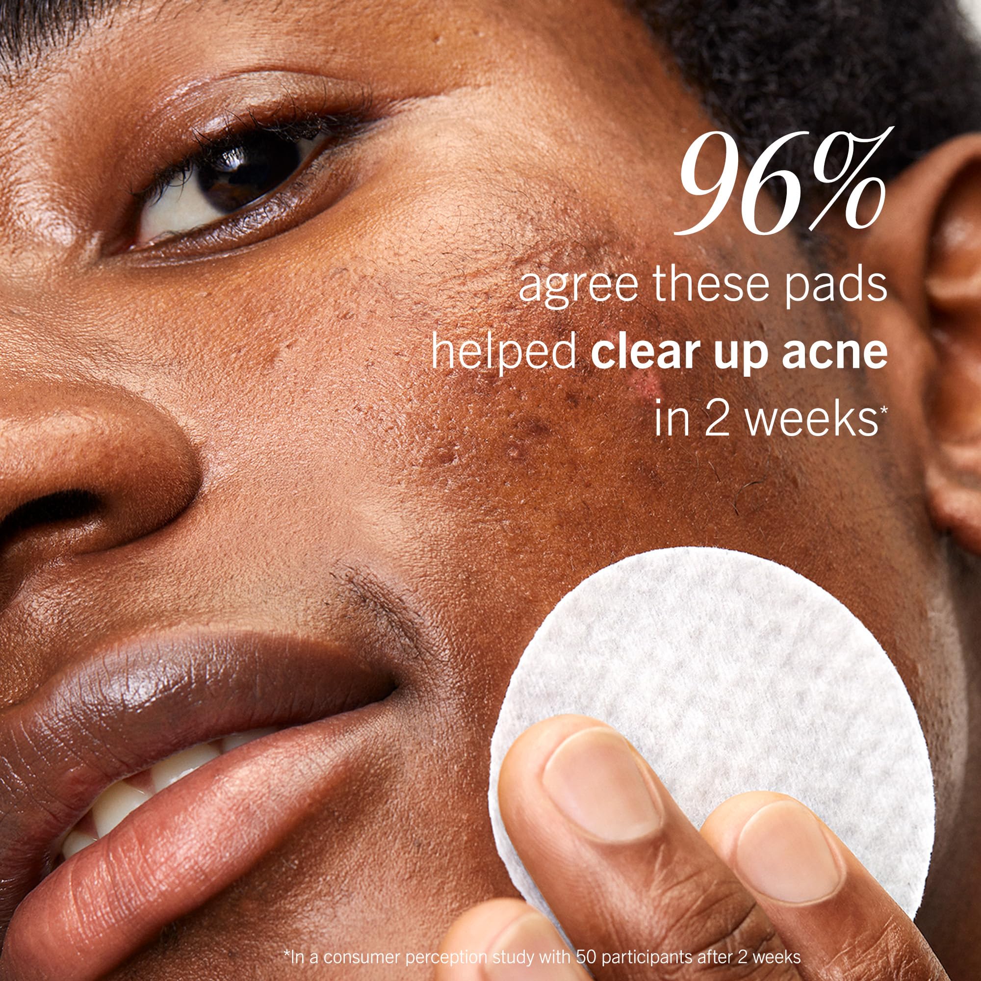 First Aid Beauty acne pads fragrance-free label on packaging.