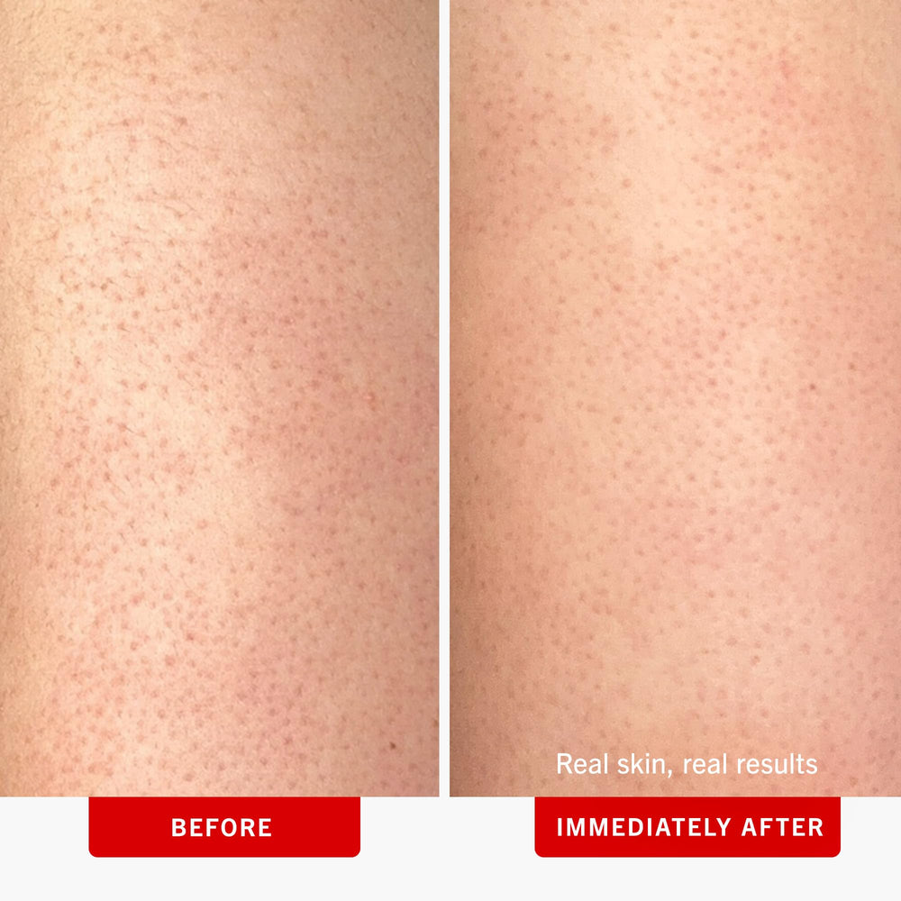 Packaging highlights 10% AHA exfoliation in First Aid Beauty KP Bump Eraser.