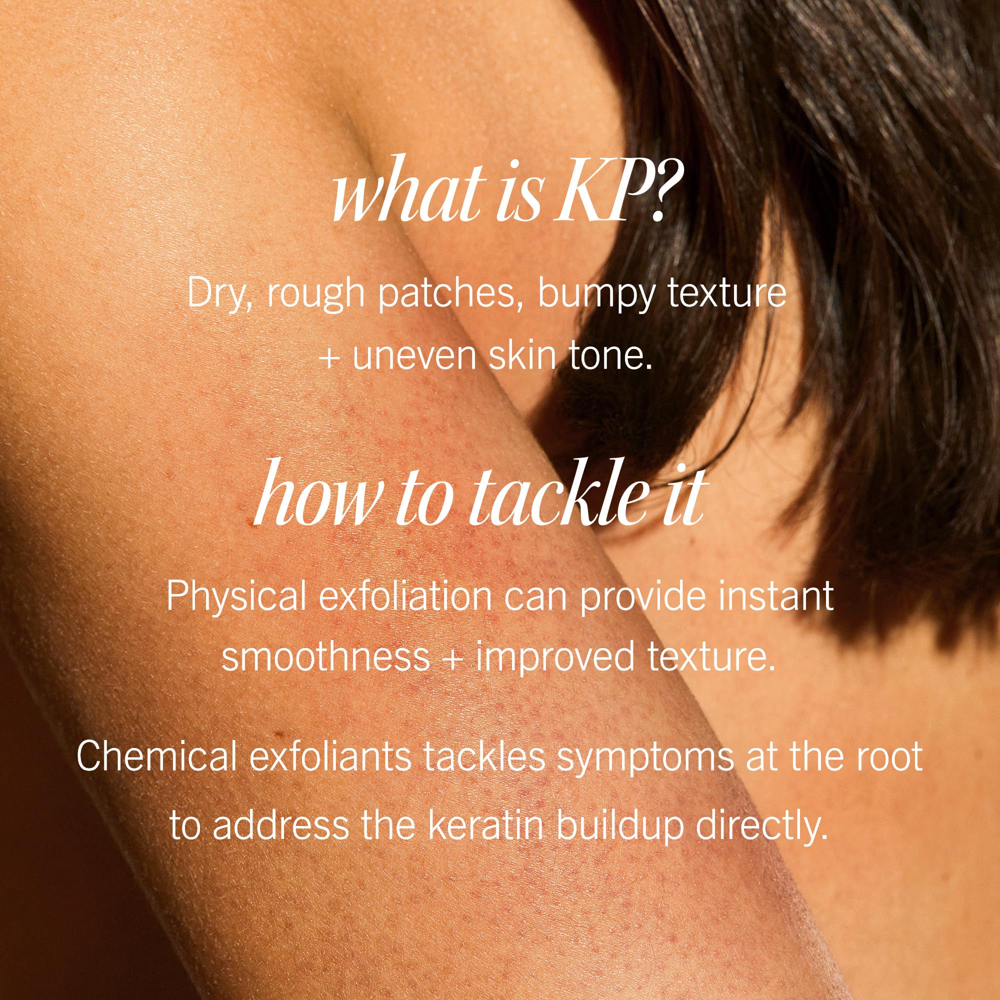 Pump top of First Aid Beauty KP Bump Eraser for easy application.