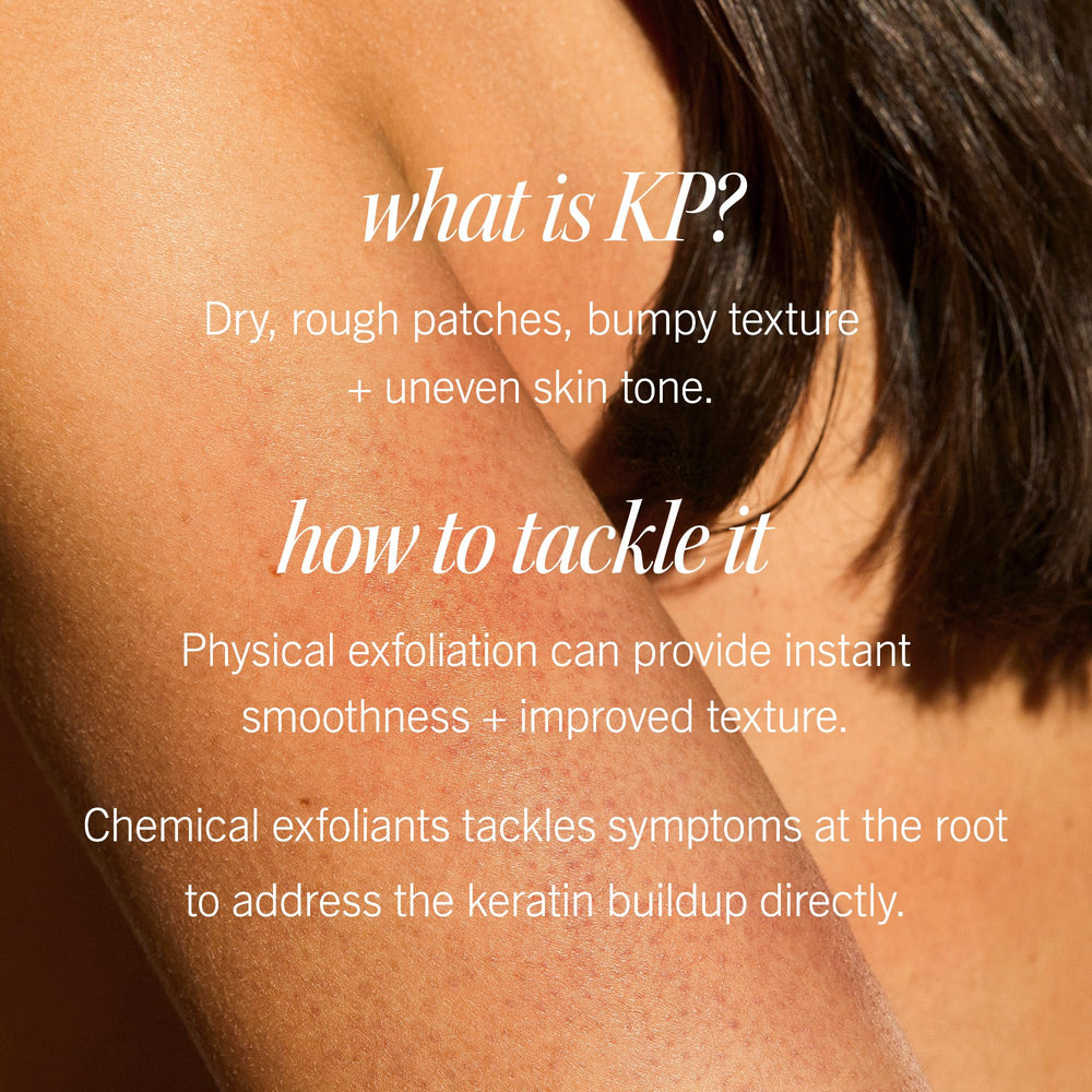 Pump top of First Aid Beauty KP Bump Eraser for easy application.
