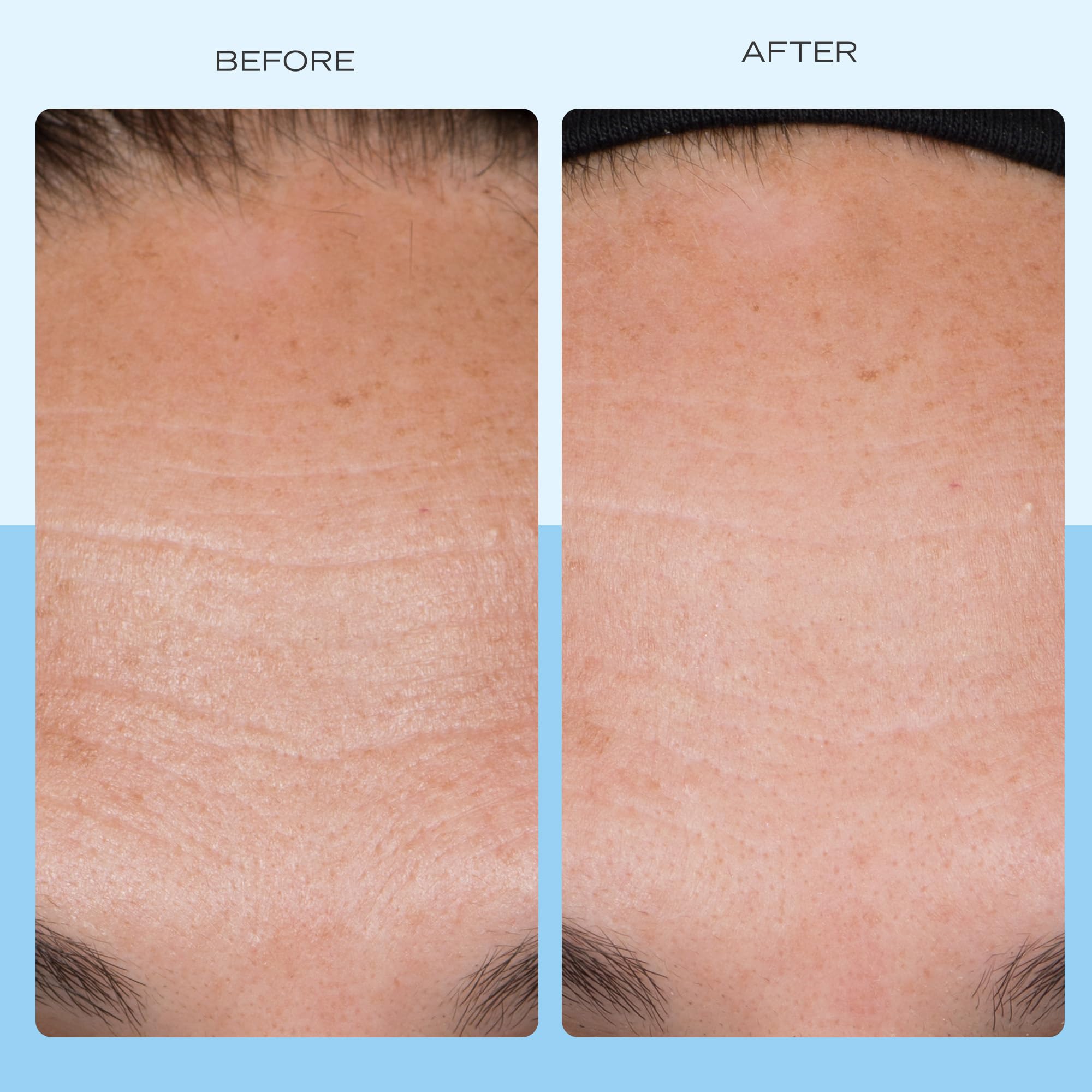 First Aid Beauty peptides niacinamide ingredients label emphasizes key skin-supporting components.