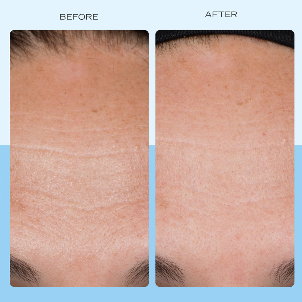 First Aid Beauty peptides niacinamide ingredients label emphasizes key skin-supporting components.