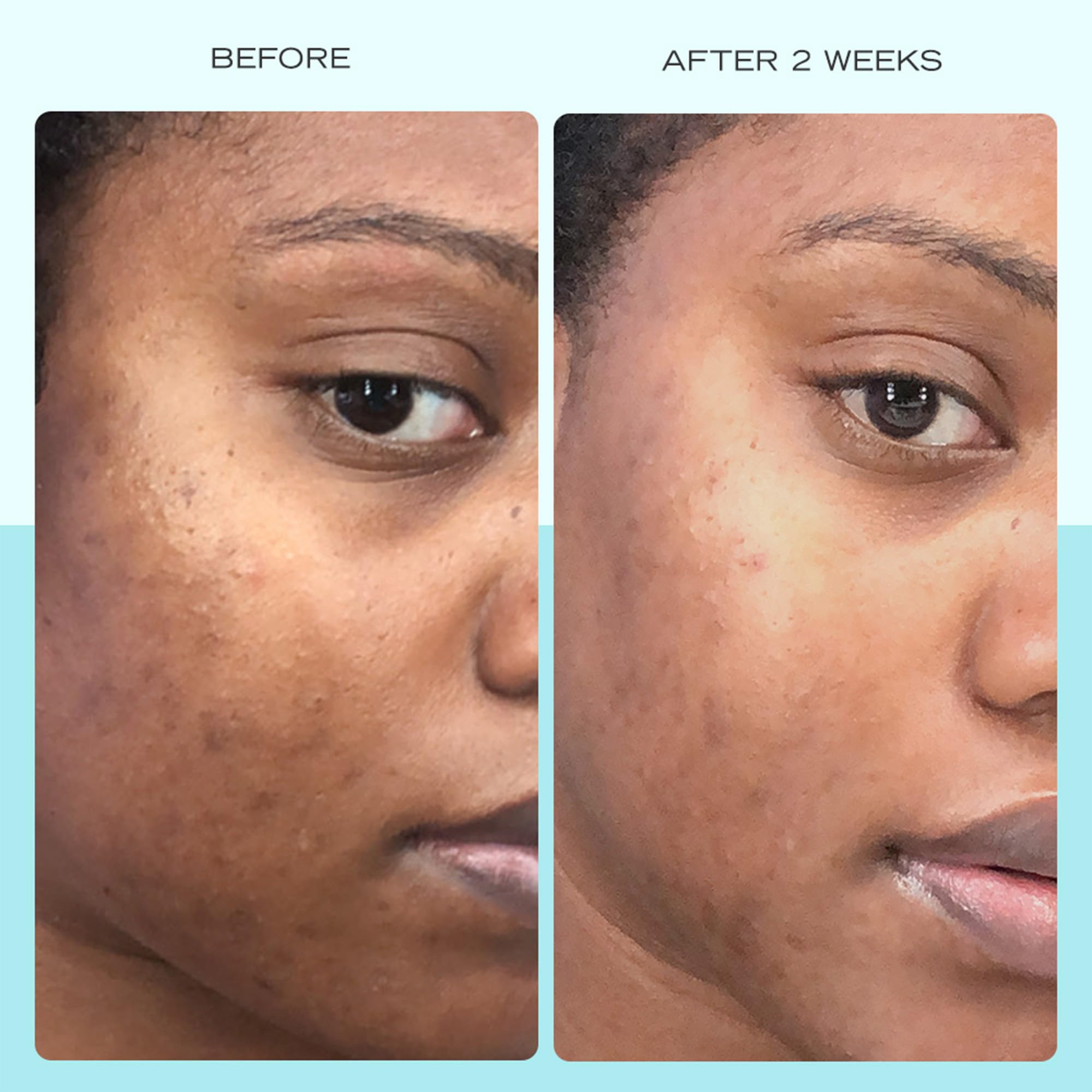 First Aid Beauty serum texture close-up reveals a lightweight, non-greasy finish.
