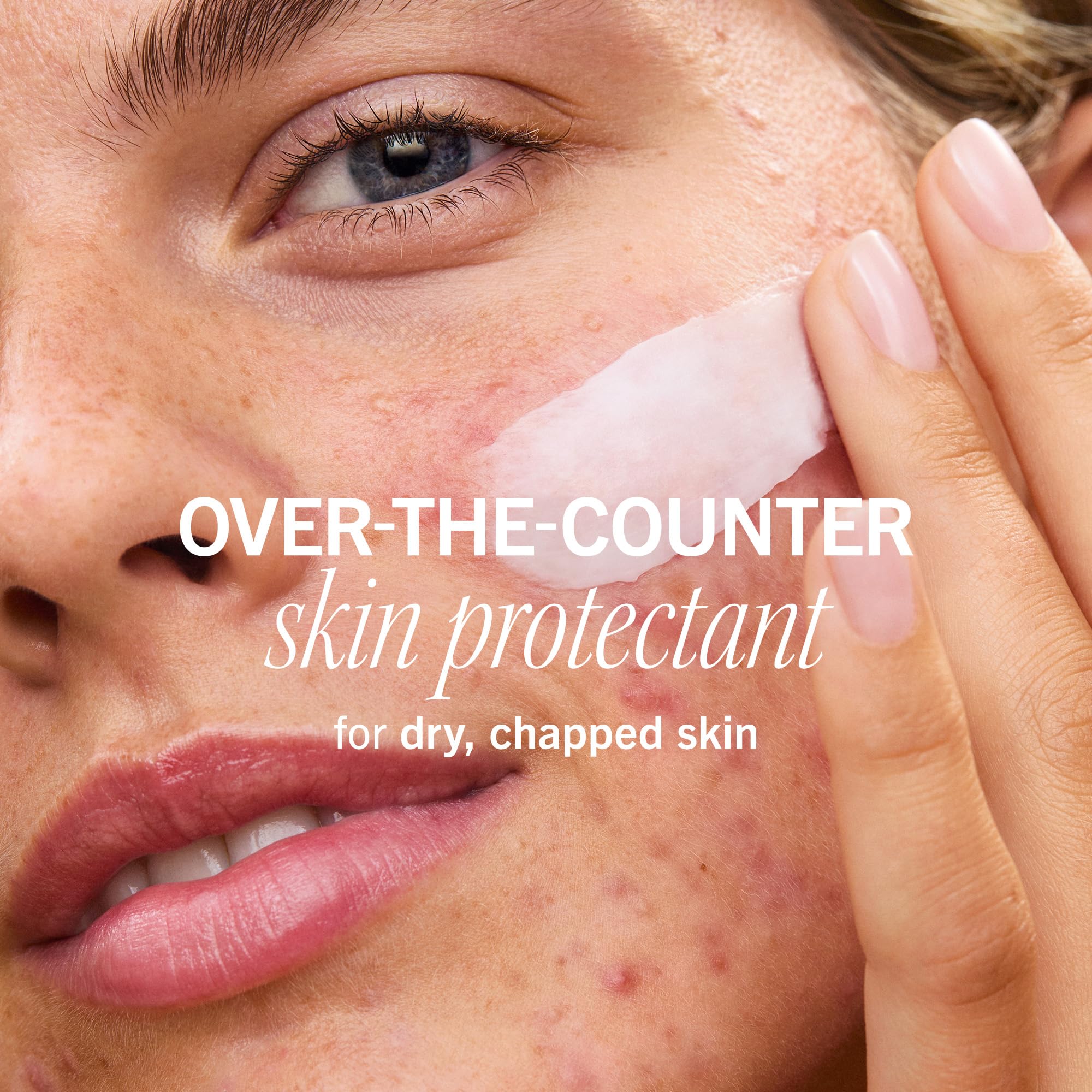 First Aid Beauty Ultra Repair Barrier Rescue Balm back view with 1% dimethicone protection.