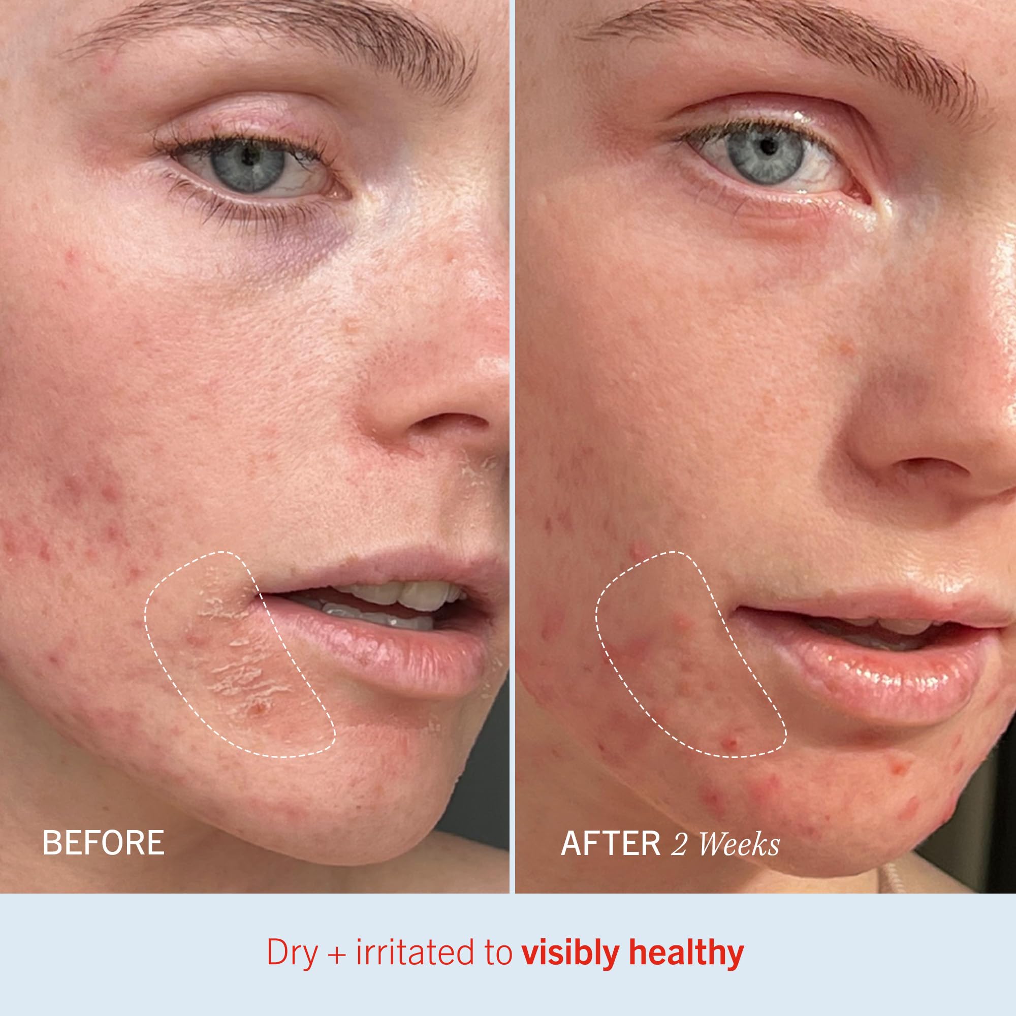 First Aid Beauty Ultra Repair Cream family-use scene emphasizing sensitive skin care
