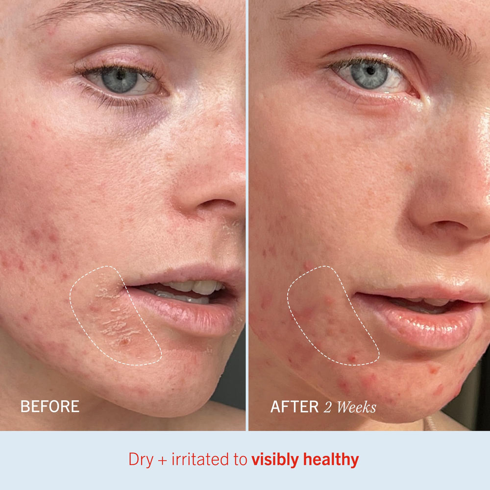 First Aid Beauty Ultra Repair Cream family-use scene emphasizing sensitive skin care
