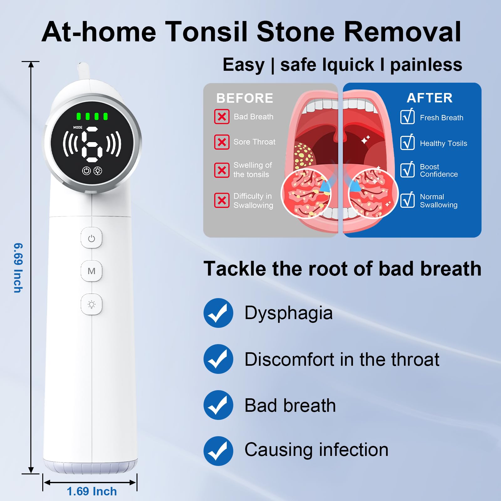 Fivepropy glass probe for tonsil stones enables gentle removal precision