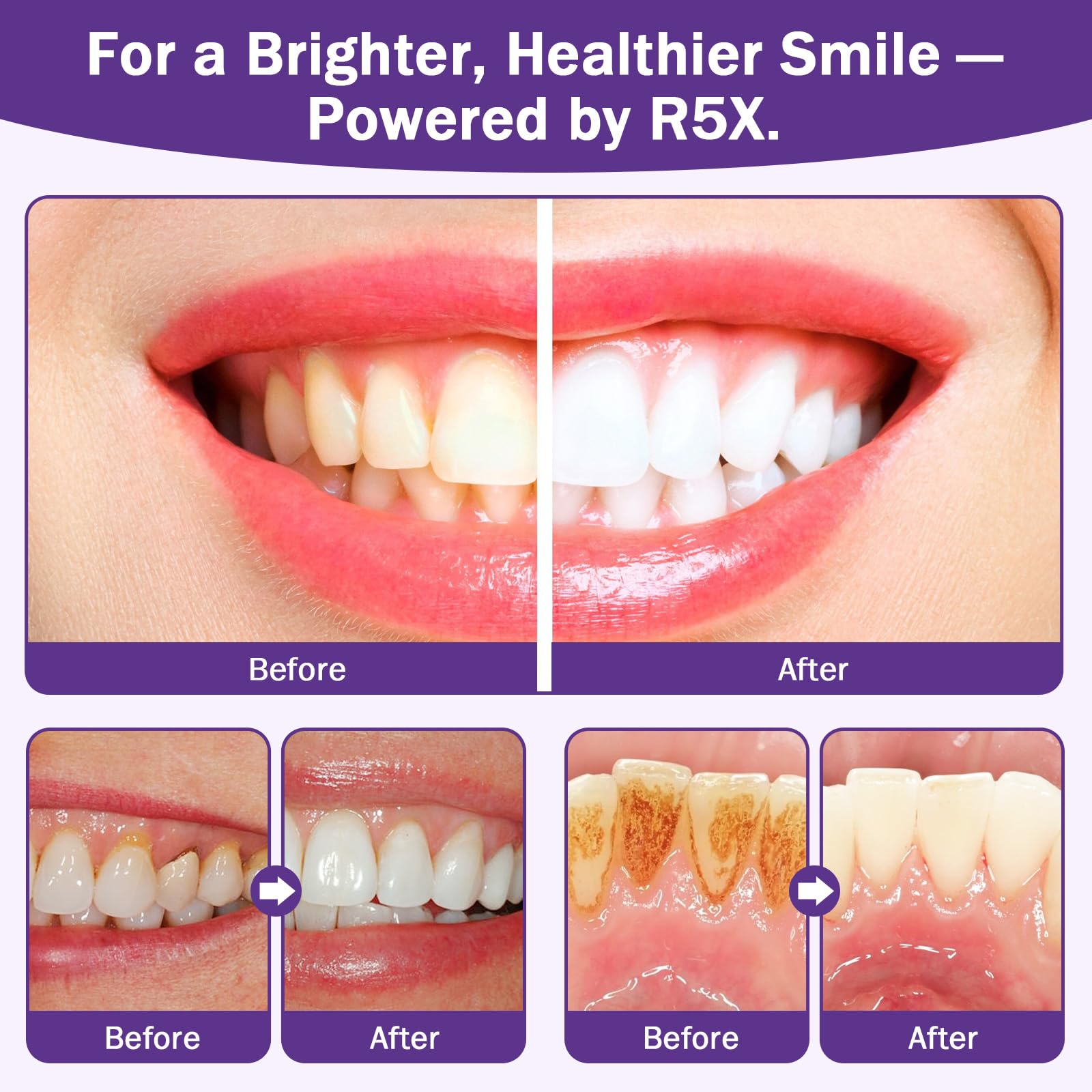 Fleird Xylitol in oral care promotes cleaner mouthfeel and protection.