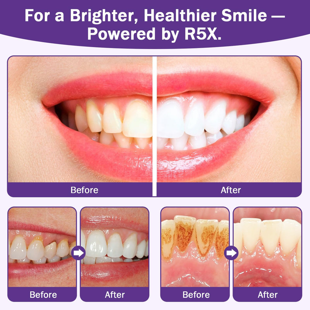 Fleird Xylitol in oral care promotes cleaner mouthfeel and protection.