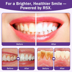 Fleird Xylitol in oral care promotes cleaner mouthfeel and protection.