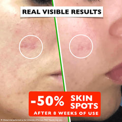 Florence Vitamin C Serum applied to neck and eye area for glow.