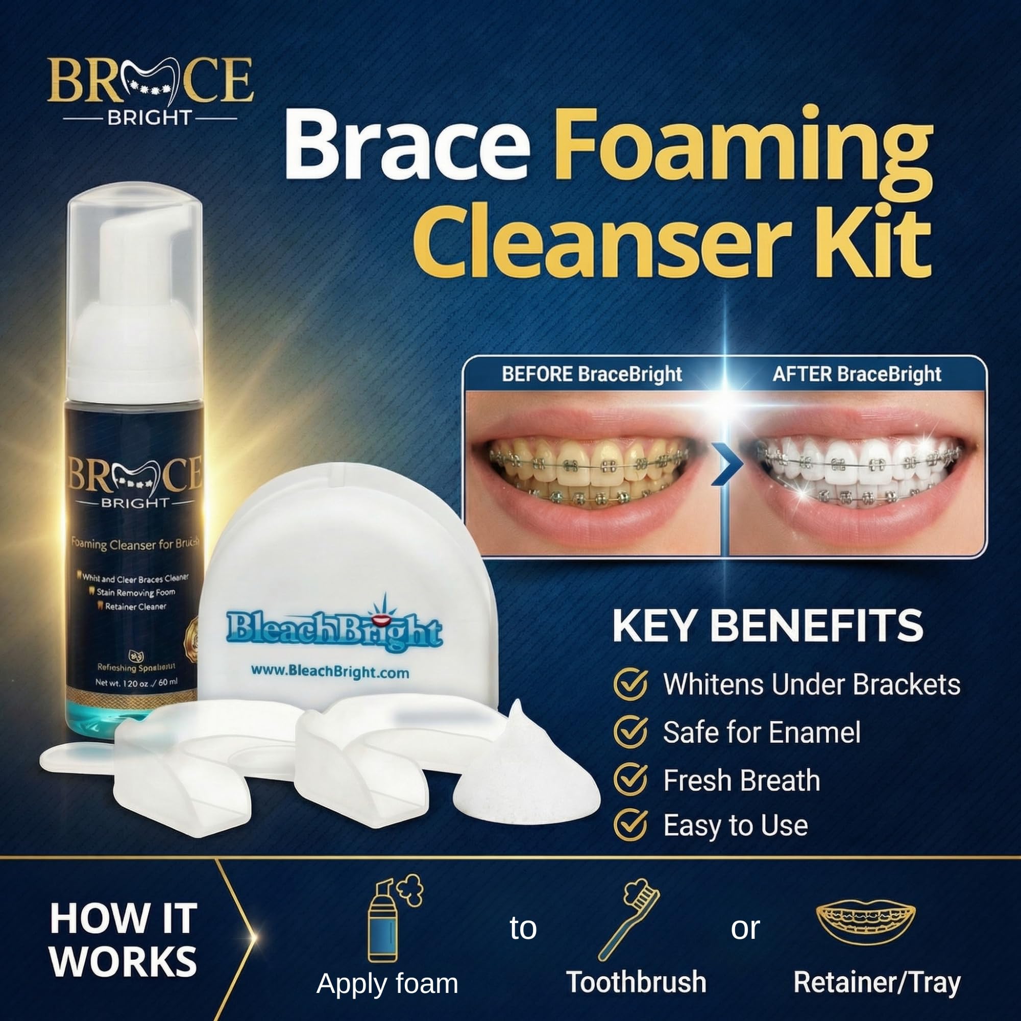 Foam Bright orthodontic whitening kit application showing braces-friendly whitening.