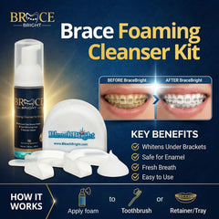 Foam Bright orthodontic whitening kit application showing braces-friendly whitening.