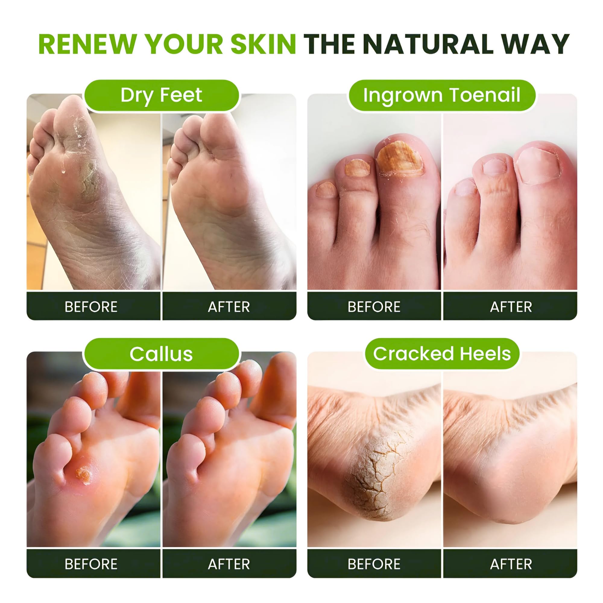 FOOT CURE american-made-foot-soak packaging showcases quality.