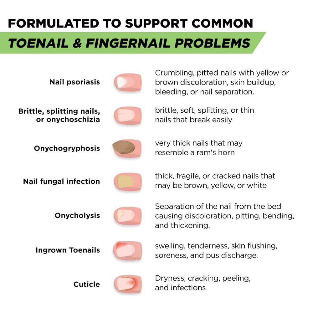 Foot Cure Nail Repair Pen in use as part of daily nail care routine