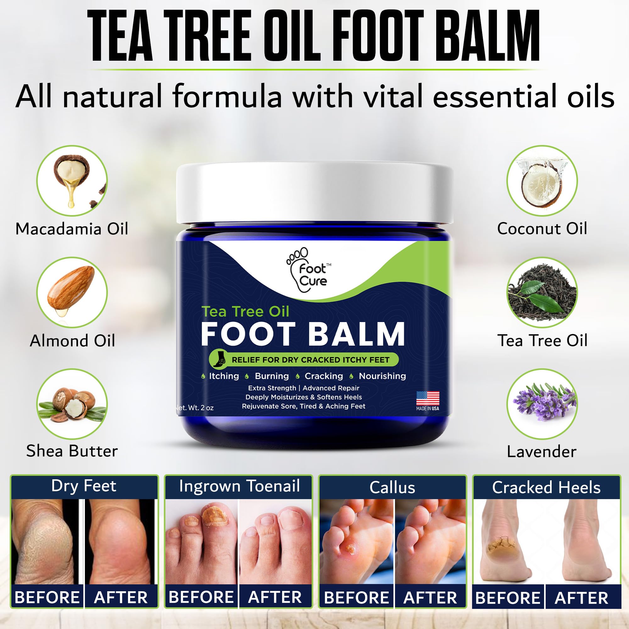 FOOT CURE tea tree oil-infused cream highlights natural ingredients