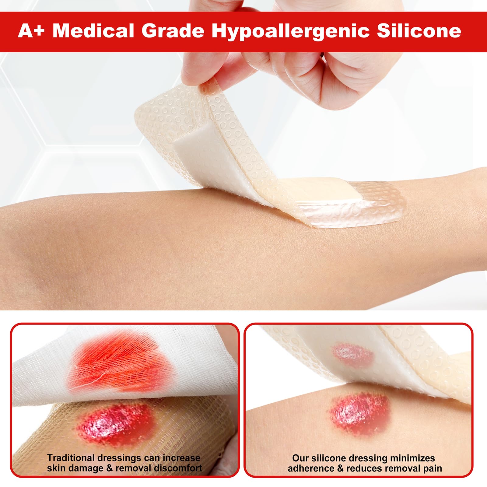 FRESINIDER bordered dressing edge protects wound margins