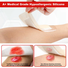 FRESINIDER bordered dressing edge protects wound margins