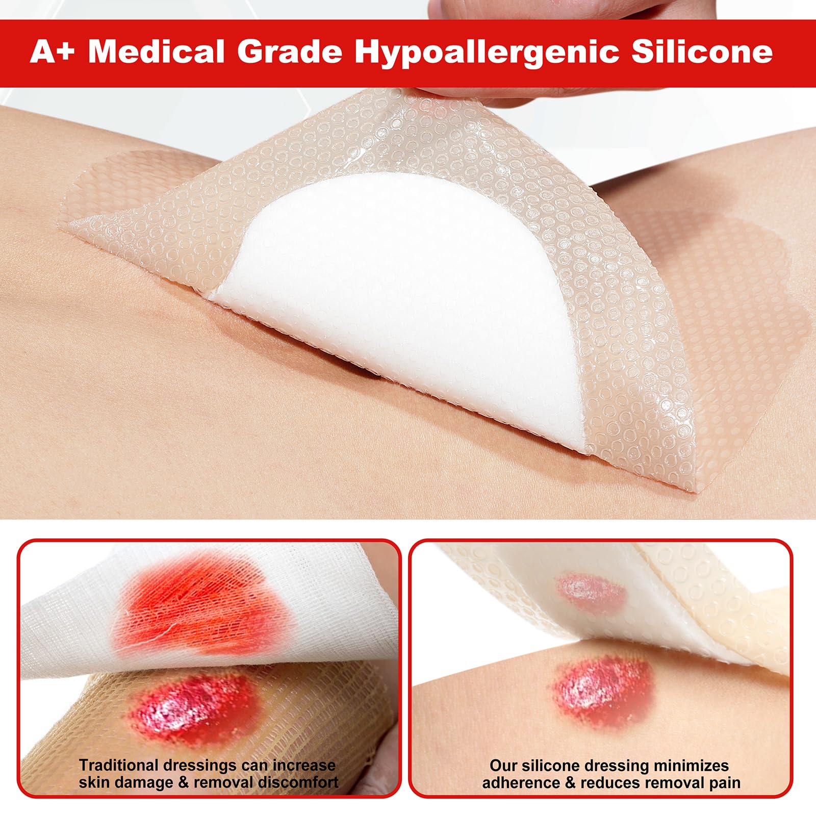 FRESINIDER nonwoven layer disperses exudate for even healing environment.