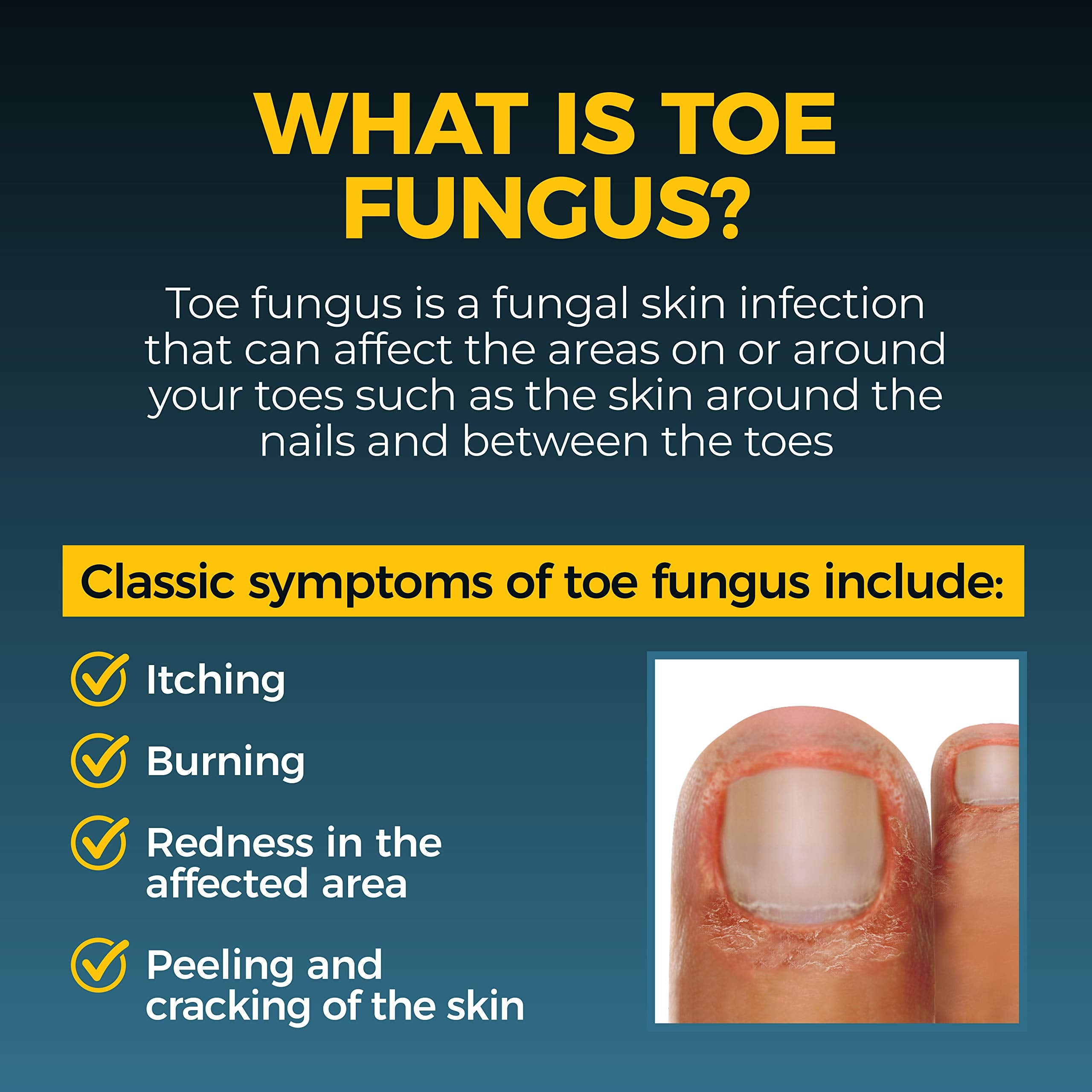 Fungi-Nail pack of two bottles for home use and travel.