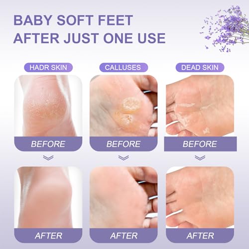 Funnir Foot Peeling Mask supports a unisex fit for various sizes.