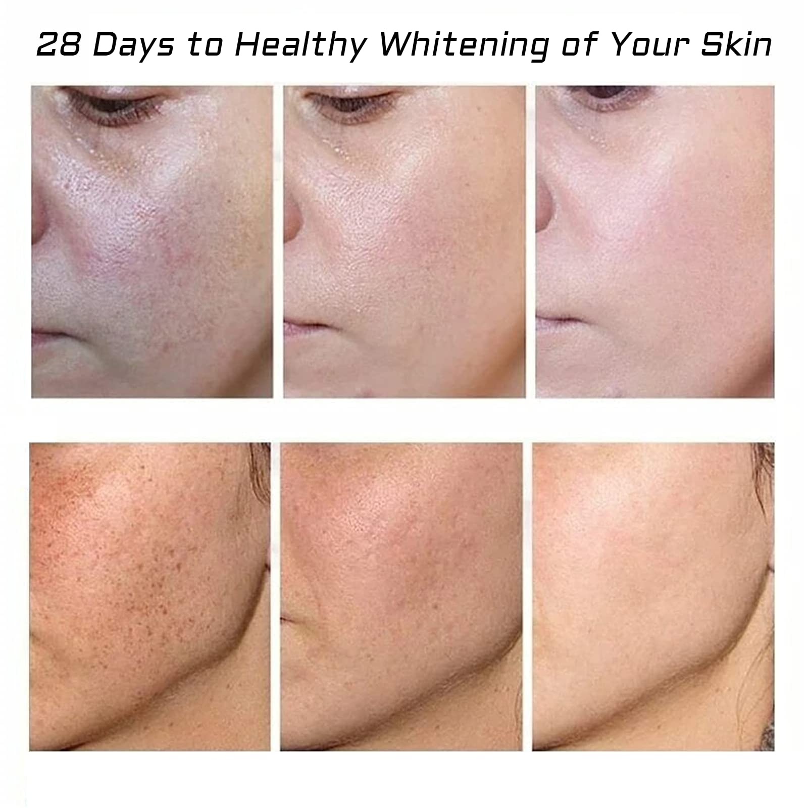 Fupah whitening freckle cream ingredients list highlights natural plant actives