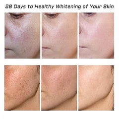 Fupah whitening freckle cream ingredients list highlights natural plant actives