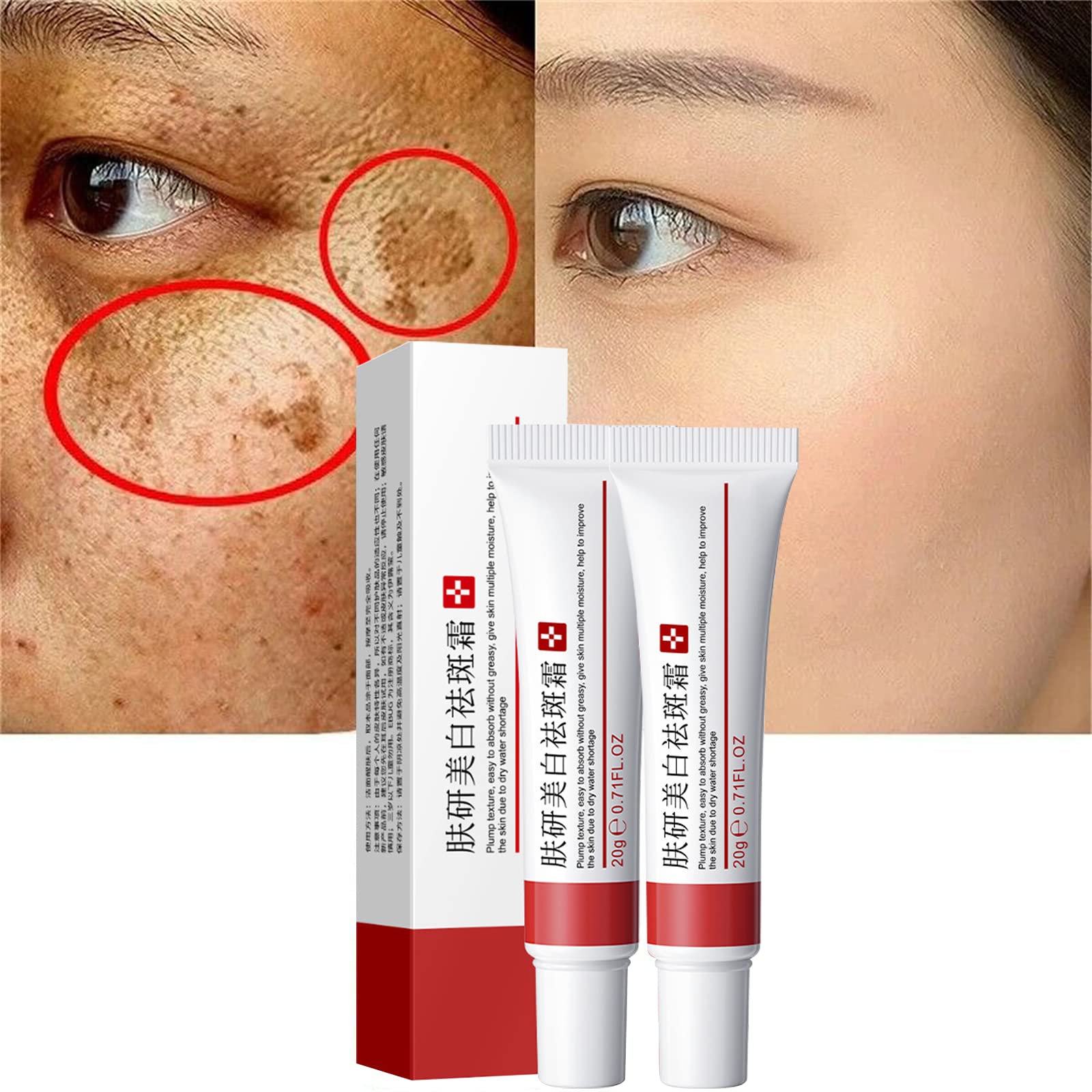 Fupah whitening freckle cream packaging showing premium skincare for brightening