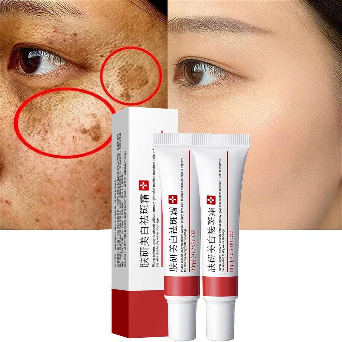 Fupah whitening freckle cream packaging showing premium skincare for brightening