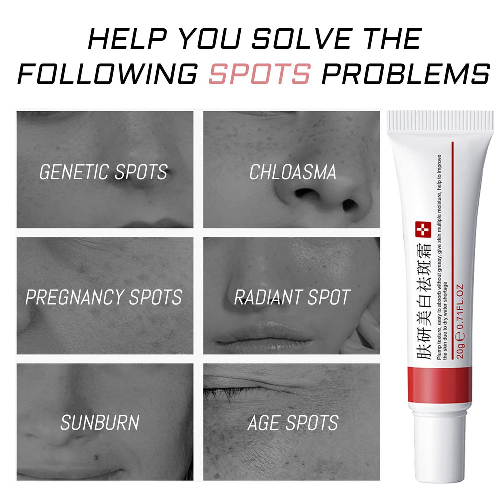 Fupah whitening freckle cream texture appears rich and creamy for daily use