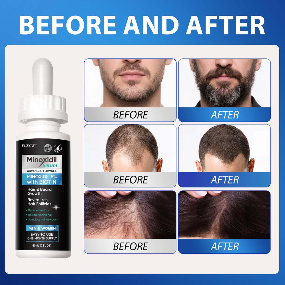 FUZYAT Lightweight non-greasy formula shown absorbing into the scalp