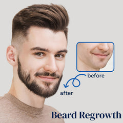 Fuzyat Minoxidil with biotin and niacinamide for scalp nourishment
