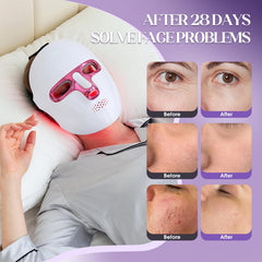 Ganoel ergonomic strap-adjusted mask comfortably fitting various faces