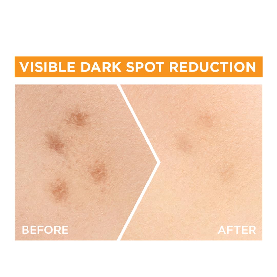 Garnier Bright Complete serum applied to face and neck during routine