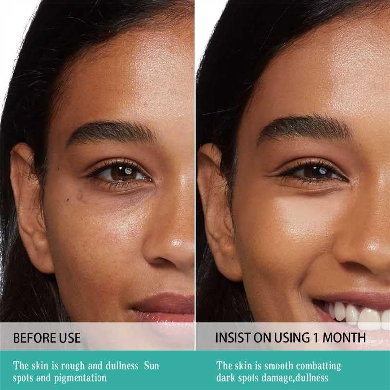 GEBUTP Relief Sun application on skin suitable for all types.