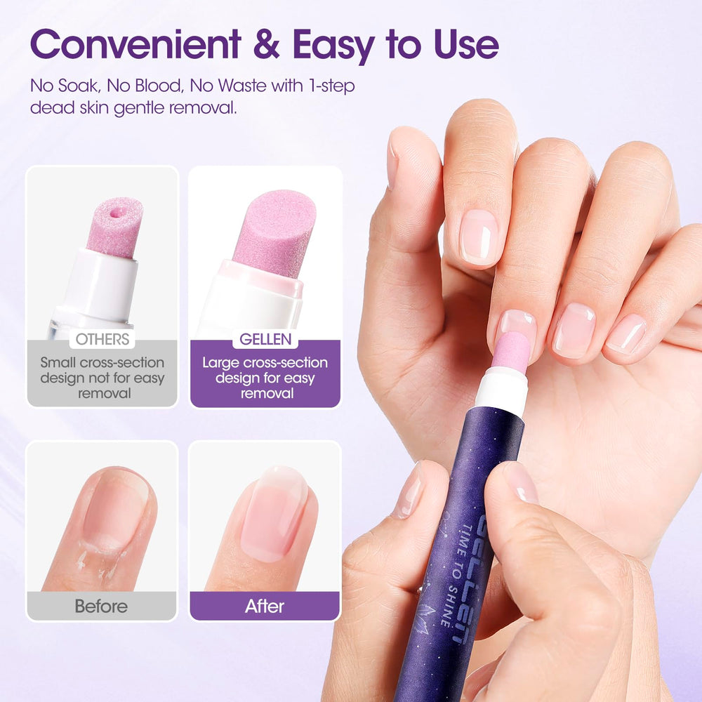 GELLEN Dead skin and hangnail removal action in progress.
