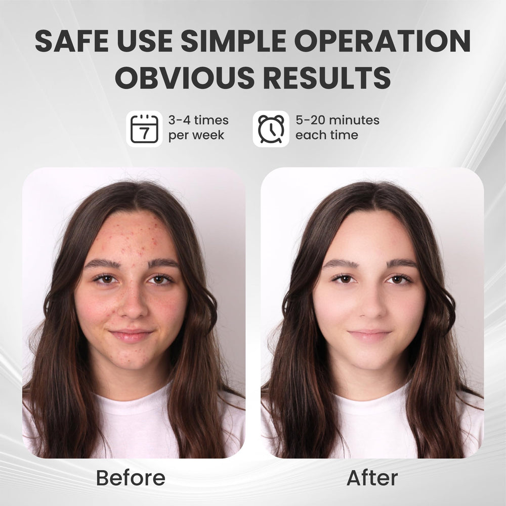 gelpal mask worn on the face highlights 60+ zones for targeted care.